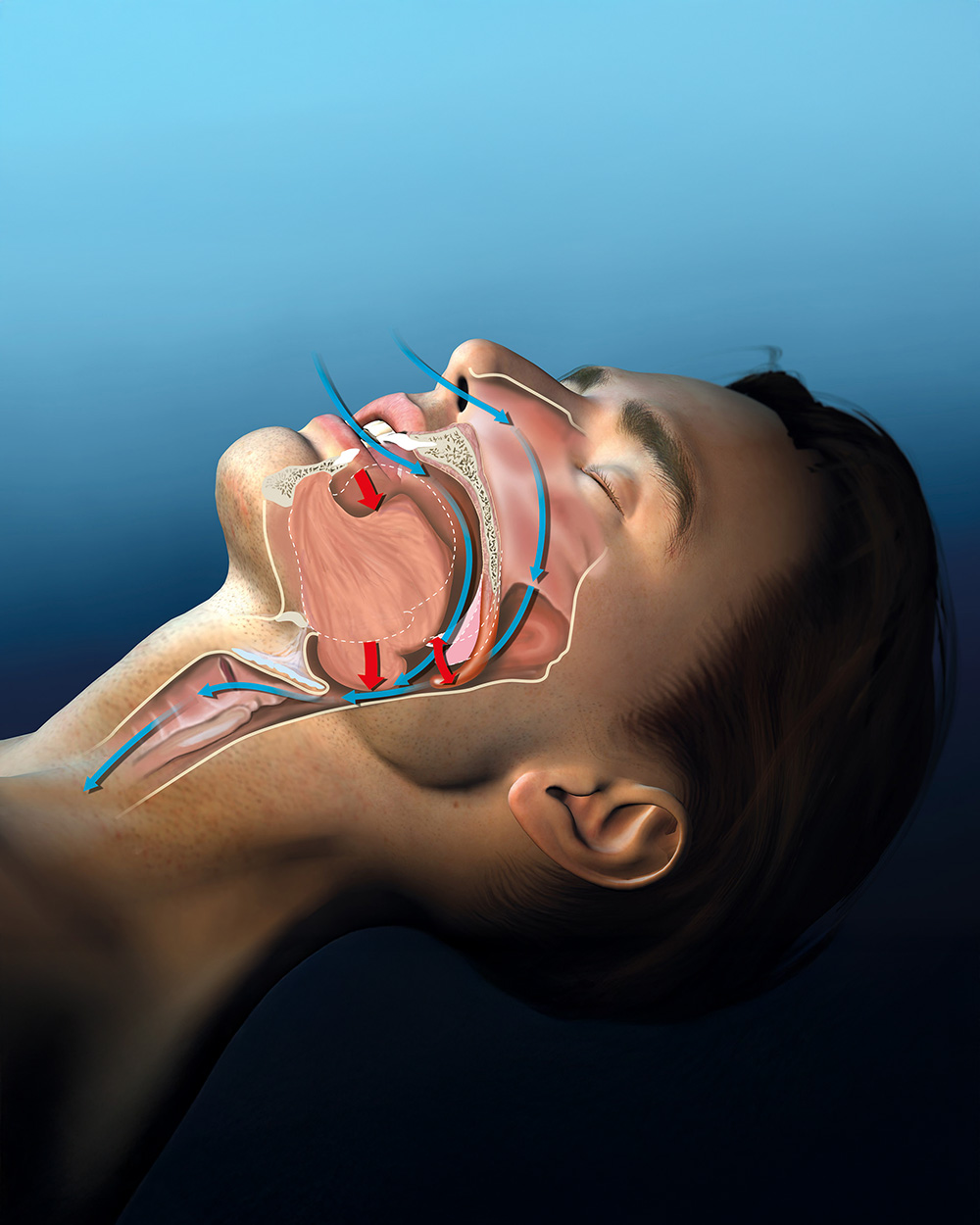 Disturbi del sonno Dentista