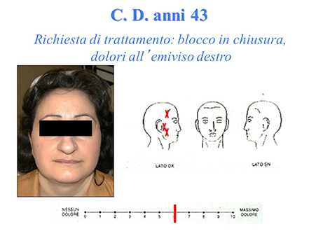 Approccio intradisciplinare gnatologico