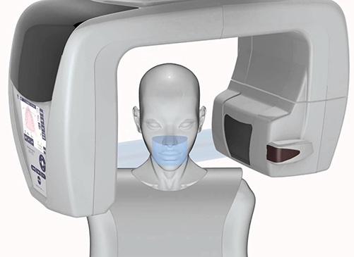 Pianificazione 3D dentista